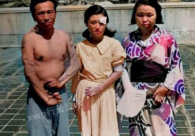 一个日本家庭遭核辐射后有多吓人？这张照片不知日本政府有何感想
